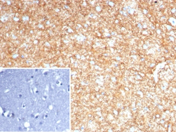 IHC staining of FFPE human brain tissue with GFAP antibody (clone GFAP/8255R). Inset: PBS used in pl