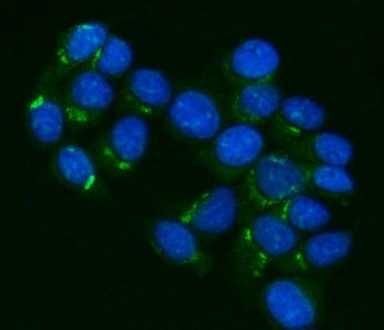 P Glycoprotein Antibody / MDR1 / ABCB1