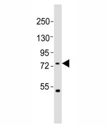 Western blot testing of FBXW7 antibody at 1:2000 dilution + HeLa lysate; Predicted molecular weight: