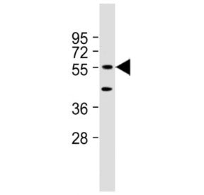 DNAJC3 Antibody (Center Region)