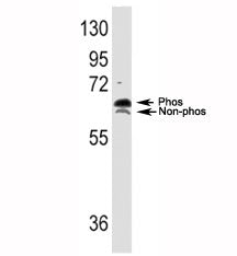 Western blot analysis of p70S6K antibody and TNF alpha activated HeLa lysate; both phospho and non-p