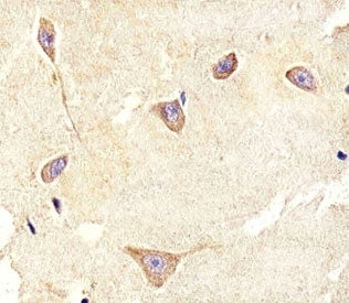 TrkC Antibody