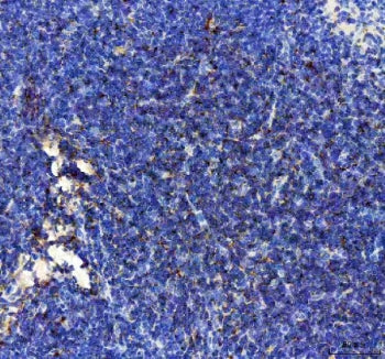 IHC staining of FFPE mouse spleen tissue with IP10 antibody. HIER: boil tissue sections in pH8 EDTA