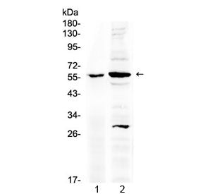 TNFR1 Antibody / TNFRSF1A