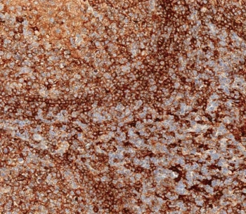 HLA-DPB1 Antibody (MHC II)