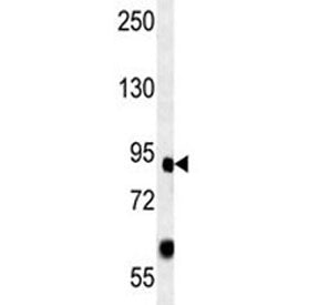 FOXP2 Antibody