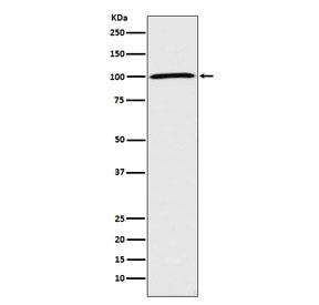 Western blot testing of human HeLa cell lysate with ATP1A1 antibody. Predicted molecular weight ~113 kDa.