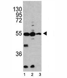 Caspase-2 Antibody, 0.08ml