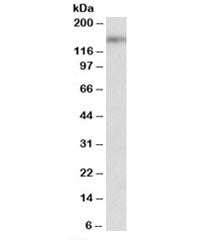 Western blot testing of mouse brain lysate with SYNGAP1 antibody at 2ug/ml. Predicted/observed molec
