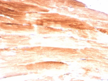 Dystrophin Antibody / DMD