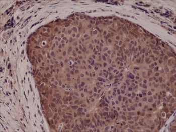 p38 MAPK Antibody