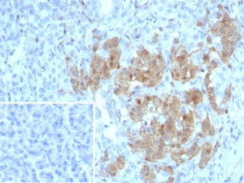 NSE Antibody / Neuron Specific Enolase
