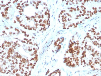 NKX3.1 Antibody