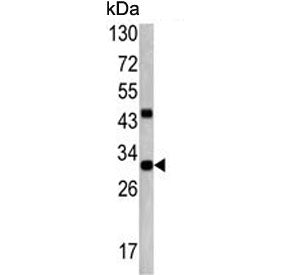 ZWINT Antibody