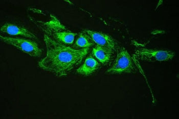 Immunofluorescent staining of human U-2 OS cells with Plectin antibody (green) and DAPI (blue). HIER