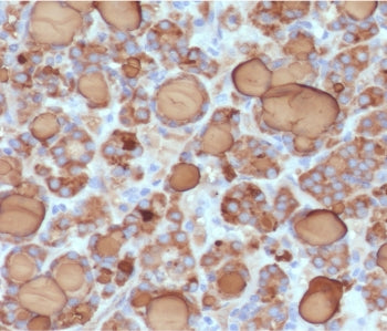 TG Antibody / Thyroglobulin