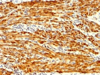 Calponin 1 Antibody