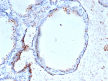 IHC staining of FFPE human thyroid tissue with GAD2 (GAD65) antibody (clone GAD2/6484). HIER: boil t