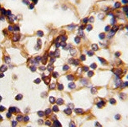 RICTOR Antibody