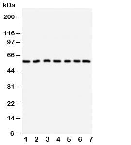 CYP11B1 Antibody