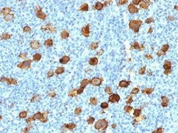 CD30 Antibody