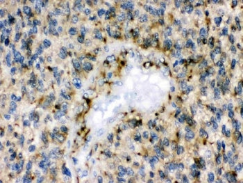 Eph Receptor B1 Antibody / EphB1