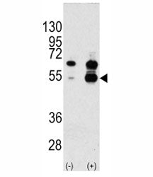 VEGFA Antibody