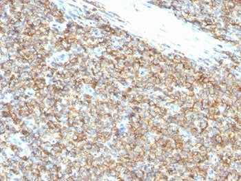 CD99 Antibody