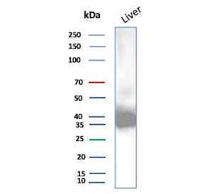 ARK1C1 Antibody / Aldo-keto Reductase Family 1 Member C1