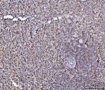 IHC staining of FFPE human spleen tissue with HES5 antibody. HIER: boil tissue sections in pH8 EDTA