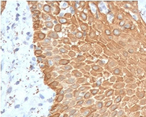 IHC staining of FFPE human skin with recombinant Multi Cytokeratin antibody (clone CTKNM-1R). HIER:
