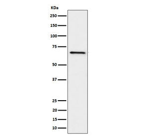 GRK6 Antibody / G protein coupled receptor kinase 6