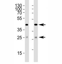 SIRT3 Antibody