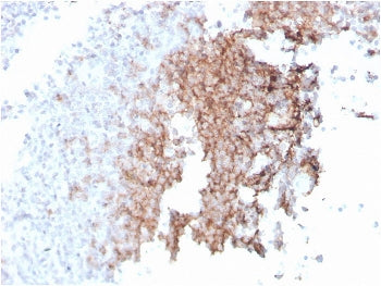 CD21 Antibody