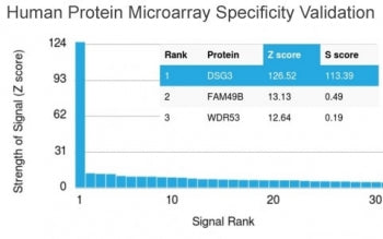 Desmoglein 3 Antibody / DSG3