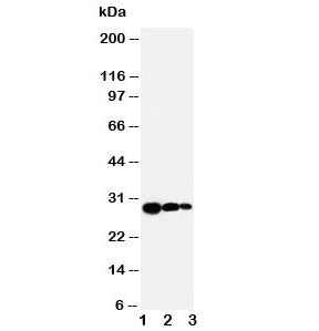 TIMP1 Antibody