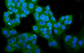 Wolframin Antibody / WFS1