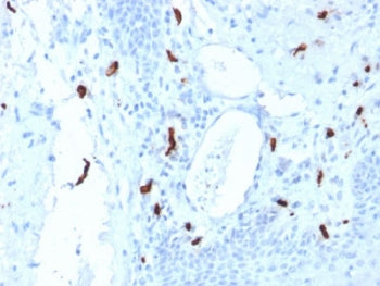 TPSAB1 Antibody / Mast Cell Tryptase