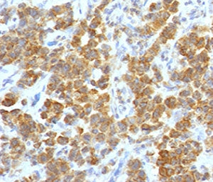TNFSF15 Antibody / VEGI / TL1A