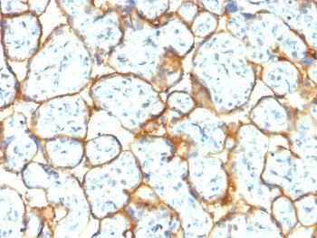 Insulin Receptor alpha Antibody