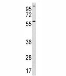 ETV5 Antibody