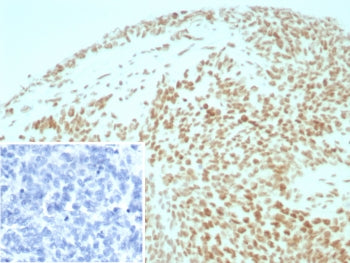 Integrase interactor 1 Antibody / INI-1 / SMARCB1 / BAF47
