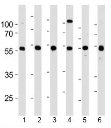 YY1 Antibody