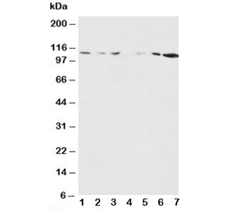 Western blot testing of NMDAR1 antibody and Lane 1: rat brain; 2: rat brain; 3: rat liver; 4: rat he