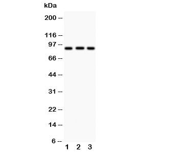 Western blot testing of CUL1 antibody and Lane 1: MM453; 2: HT1080; 3: SMMC-7721; Predicted/observed molecular weight ~90kDa.