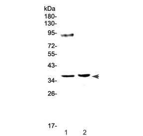 Tbp Antibody / TATA binding protein