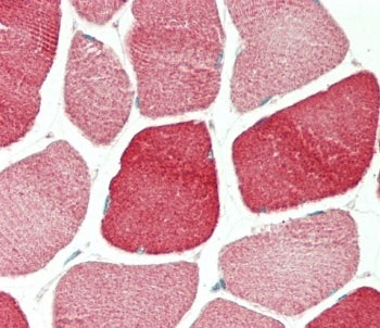 TPM4 Antibody / Tropomyosin 4