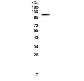 PMS2 Antibody / PMS1 homolog 2