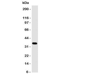 Annexin A10 Antibody