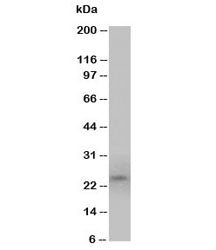 PrP Antibody Prion protein